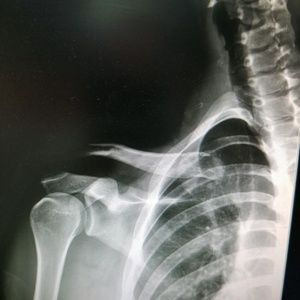 Meet your Posher, Cain